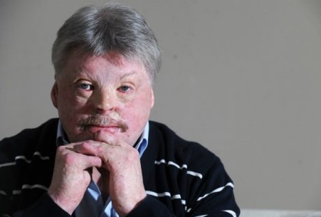 Simon Weston